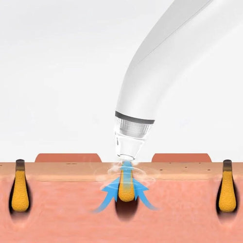 🌀 Electric Blackhead Remover — Diamond Pore Vacuum Suction & Deep Cleanser